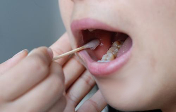 山西医院做血缘检测所需的生物样本有些什么, 山西医院做血缘检测所需的生物样本有些什么,